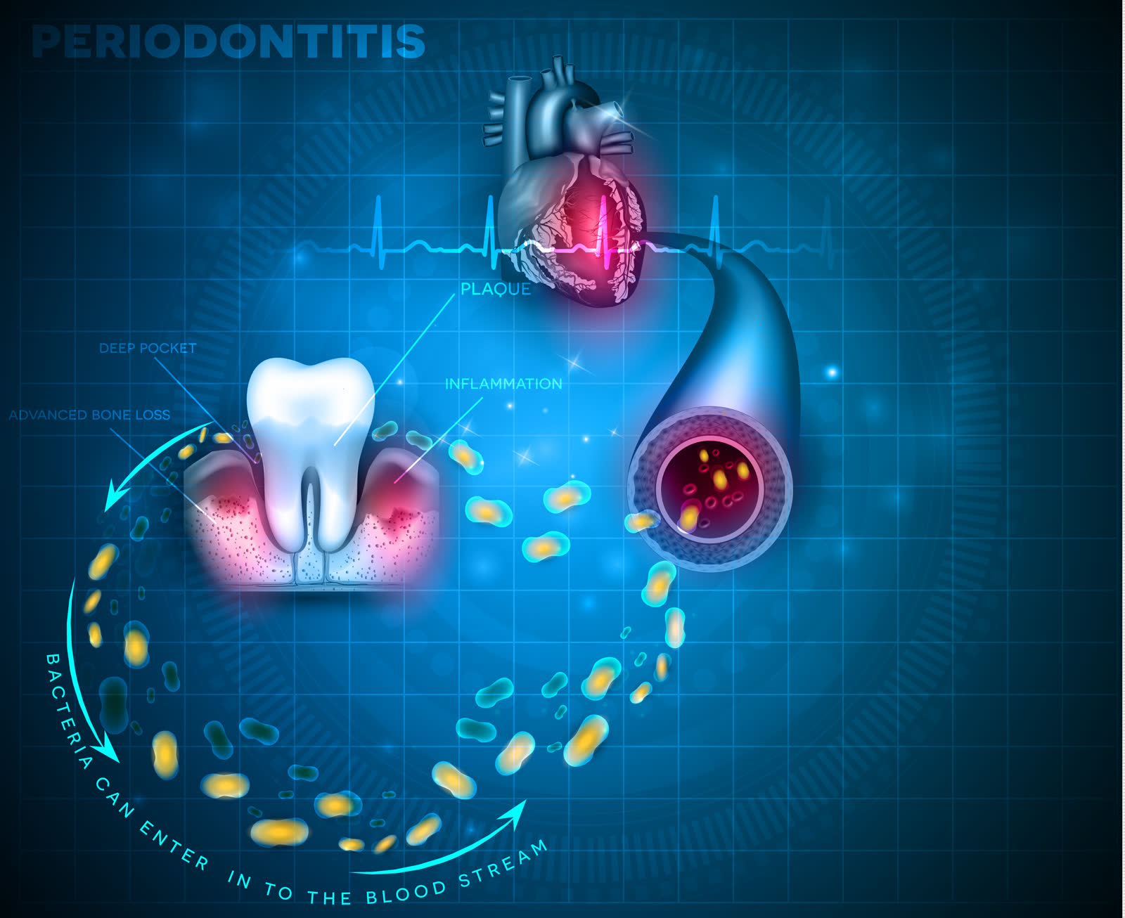 Periodontal disease treatment