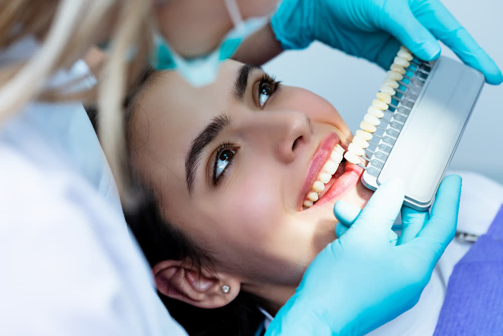 Professional teeth whitening