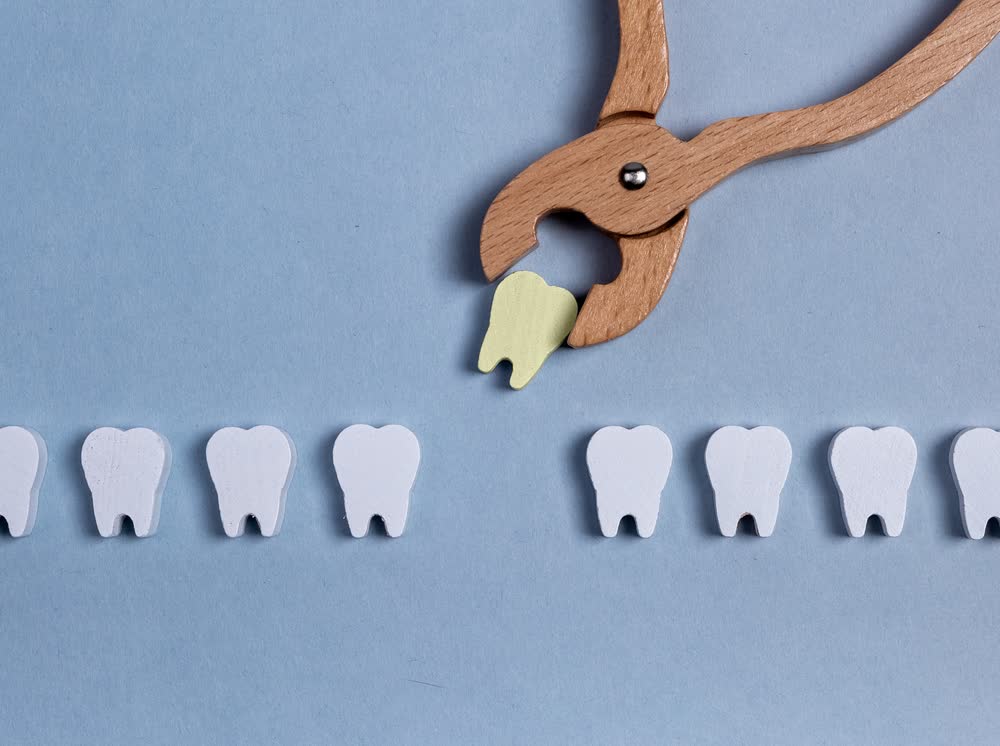 Tooth extraction care in Saginaw